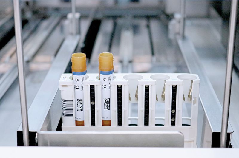 MS Free TDMs independent quality controls sit on loading track of Roche cobas analyzer